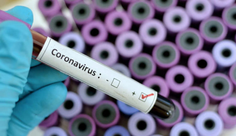 Por qué le dicen "Frankenstein" a la nueva variante del COVID que avanza en la región y preocupa a la OMS