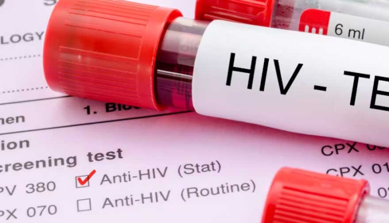 Día mundial del VIH: por qué los contagios no bajan a pesar de los nuevos métodos de prevención