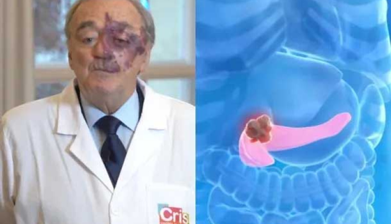 Gran hallazgo: una triple terapia abre una nueva esperanza frente al cáncer de páncreas
