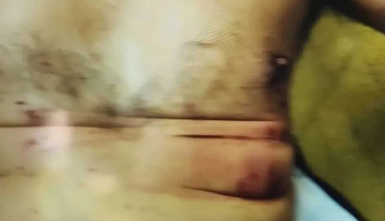 Las imágenes del oficial herido por la bomba en la Escuela Superior de Gendarmería