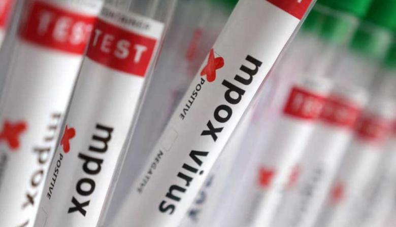 Confirman el primer caso de viruela símica Clado Ib en Argentina: se asocia a mayor gravedad y contagiosidad