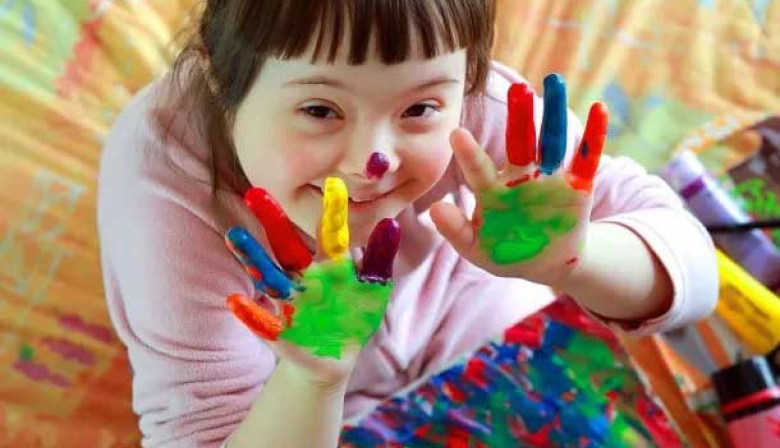 Día del Síndrome de Down: por qué se conmemora el 21 de marzo