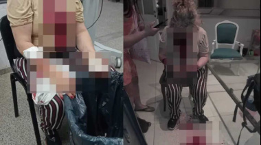 Brutal intento de femicidio en Chaco: un hombre quiso matar a su expareja cortándole el cuello