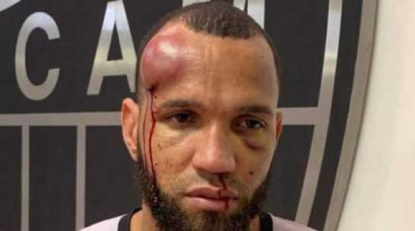 Récord de expulsados en una final del fútbol brasileño: 23 jugadores recibieron la tarjeta roja