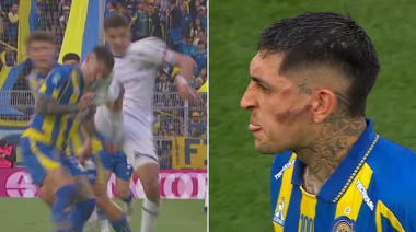 El comunicado de Rosario Central tras la patada que recibió Gastón Ávila ante Independiente Rivadavia: “Náuseas y cefalea intensa”
