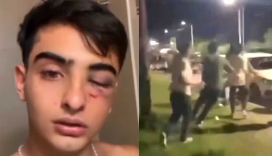 Ataque de 20 rugbiers en Tucumán: detuvieron a dos de los acusados de golpear y tirar a un joven a una zanja