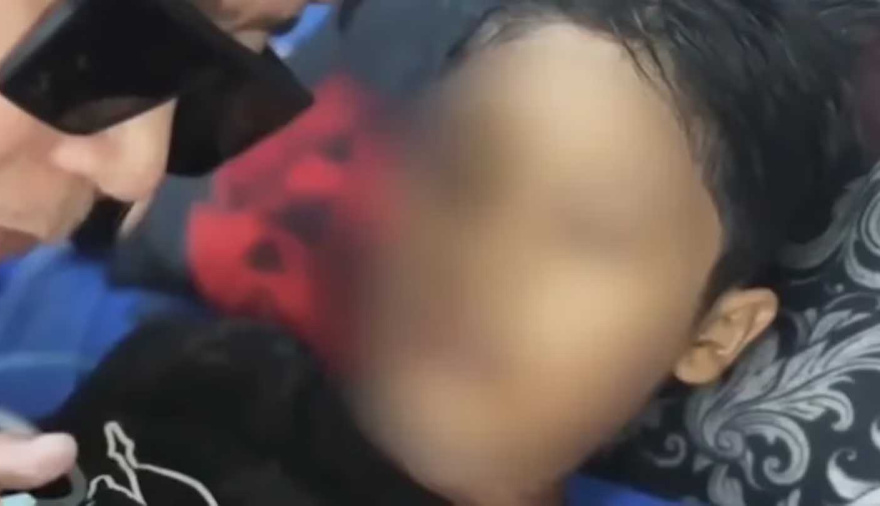 Obligaron a un nene de 12 años a tomar agua hirviendo en Indonesia: antes de morir acusó a su madrastra