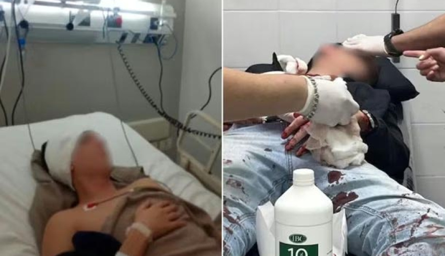 Brutal golpiza homofóbica en Tucumán: una de las víctimas quedó en terapia intensiva