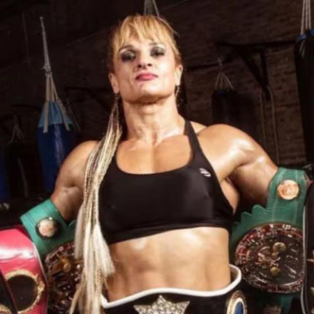 El último parte médico de Alejandra "Locomotora" Oliveras después de ser operada por un ACV