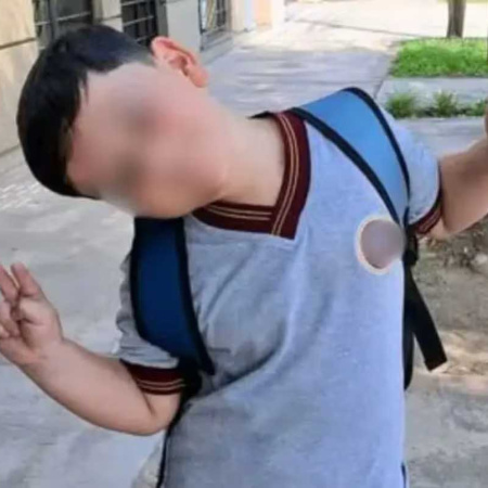 Volvieron a operar a Bastian y su mamá pide dadores de sangre