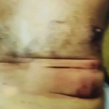 Las imágenes del oficial herido por la bomba en la Escuela Superior de Gendarmería