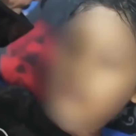 Obligaron a un nene de 12 años a tomar agua hirviendo en Indonesia: antes de morir acusó a su madrastra