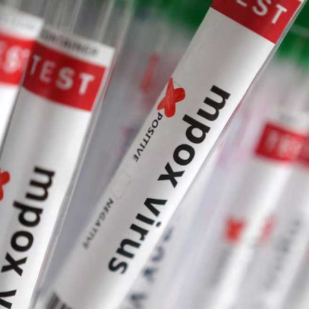 Confirman el primer caso de viruela símica Clado Ib en Argentina: se asocia a mayor gravedad y contagiosidad