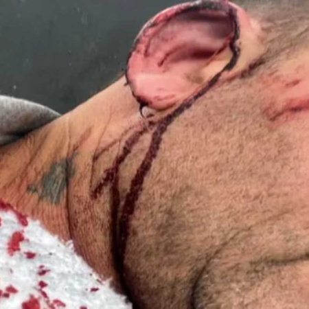Un intendente fue atacado por un concejal y sufrió lesiones en la cabeza