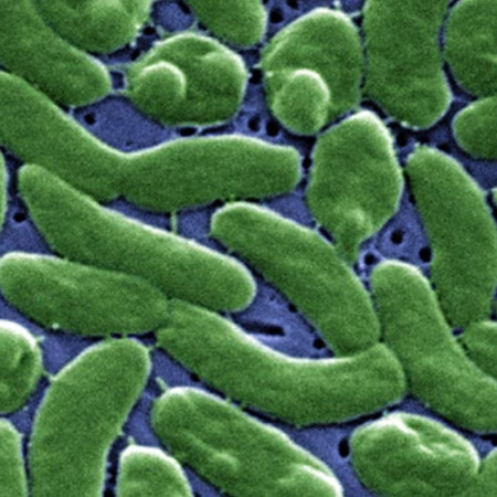 Alerta por la bacteria come carne en EE.UU.: ya son doce doce los muertos en Florida y Luisiana